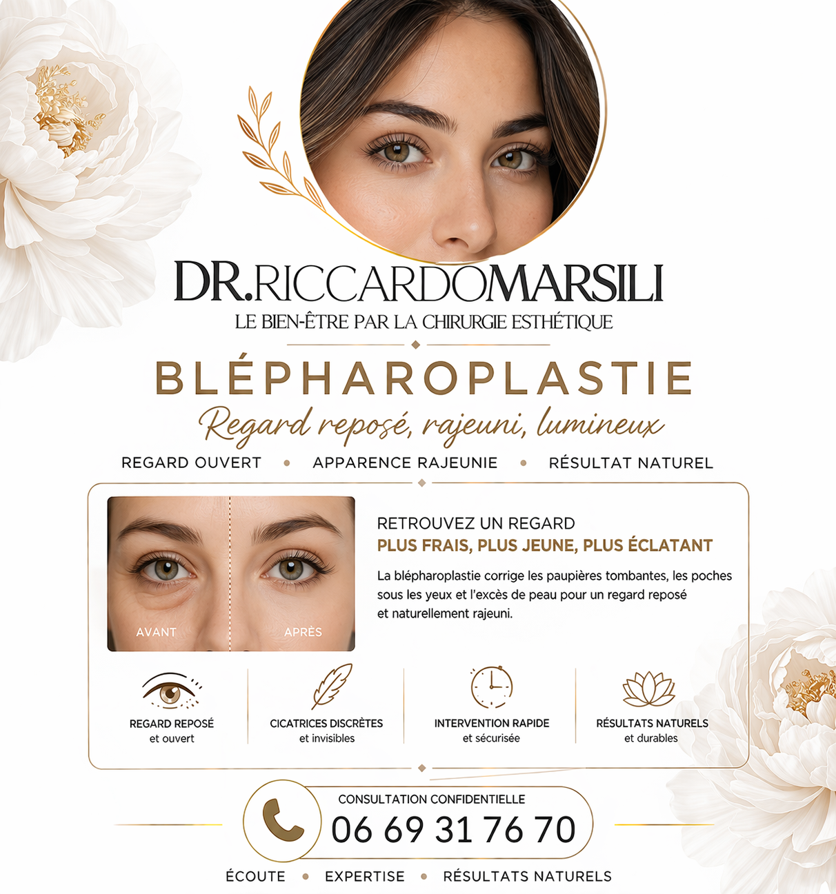 Blépharoplastie Paris 16