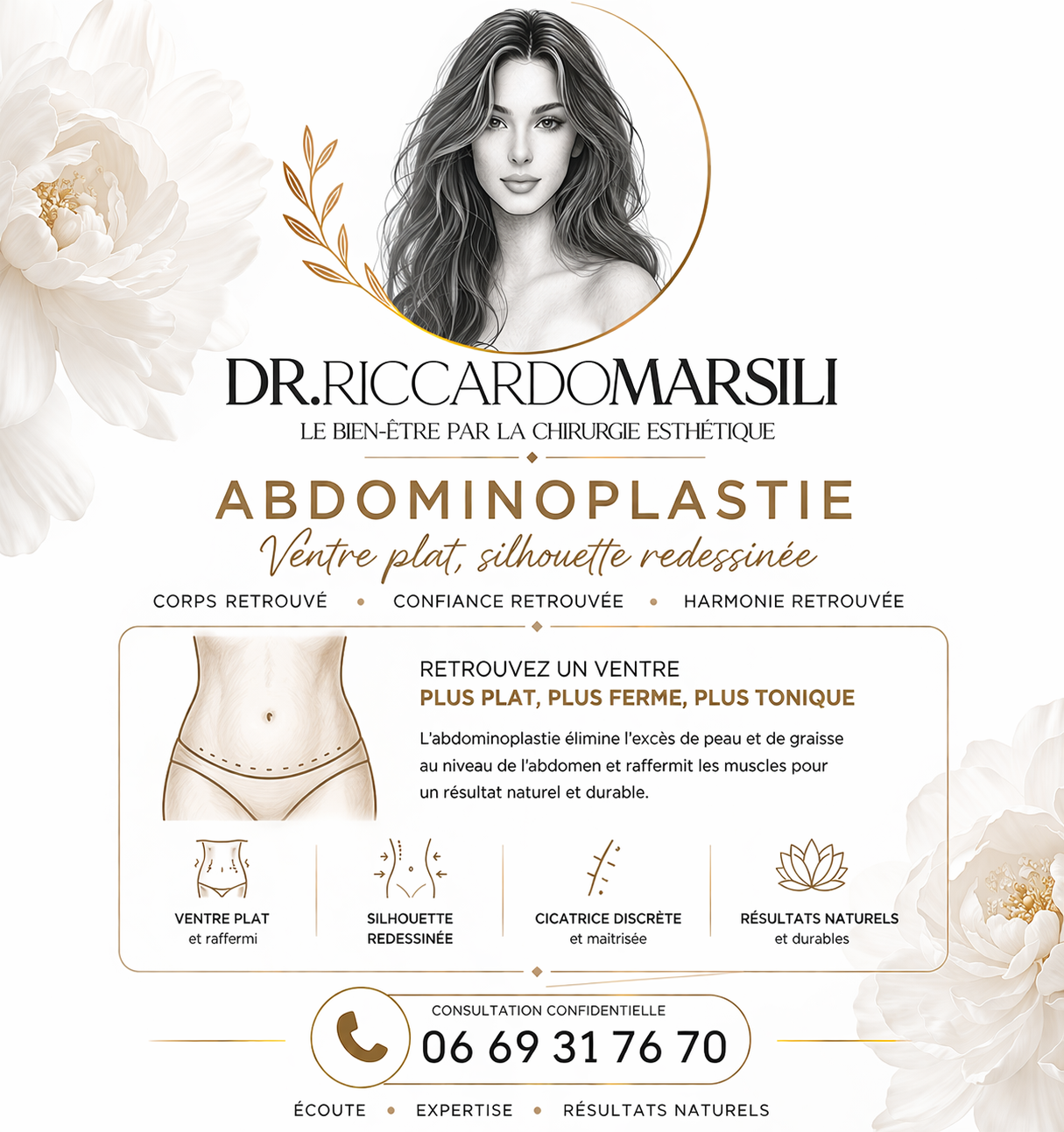 Guide complet sur abdominoplastie à Paris 16